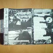 Der musikalische text FILMS KILLS von MALIGNANT TUMOUR ist auch in dem Album vorhanden Killing for profit (1997)