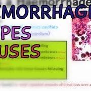 Haemorrhage